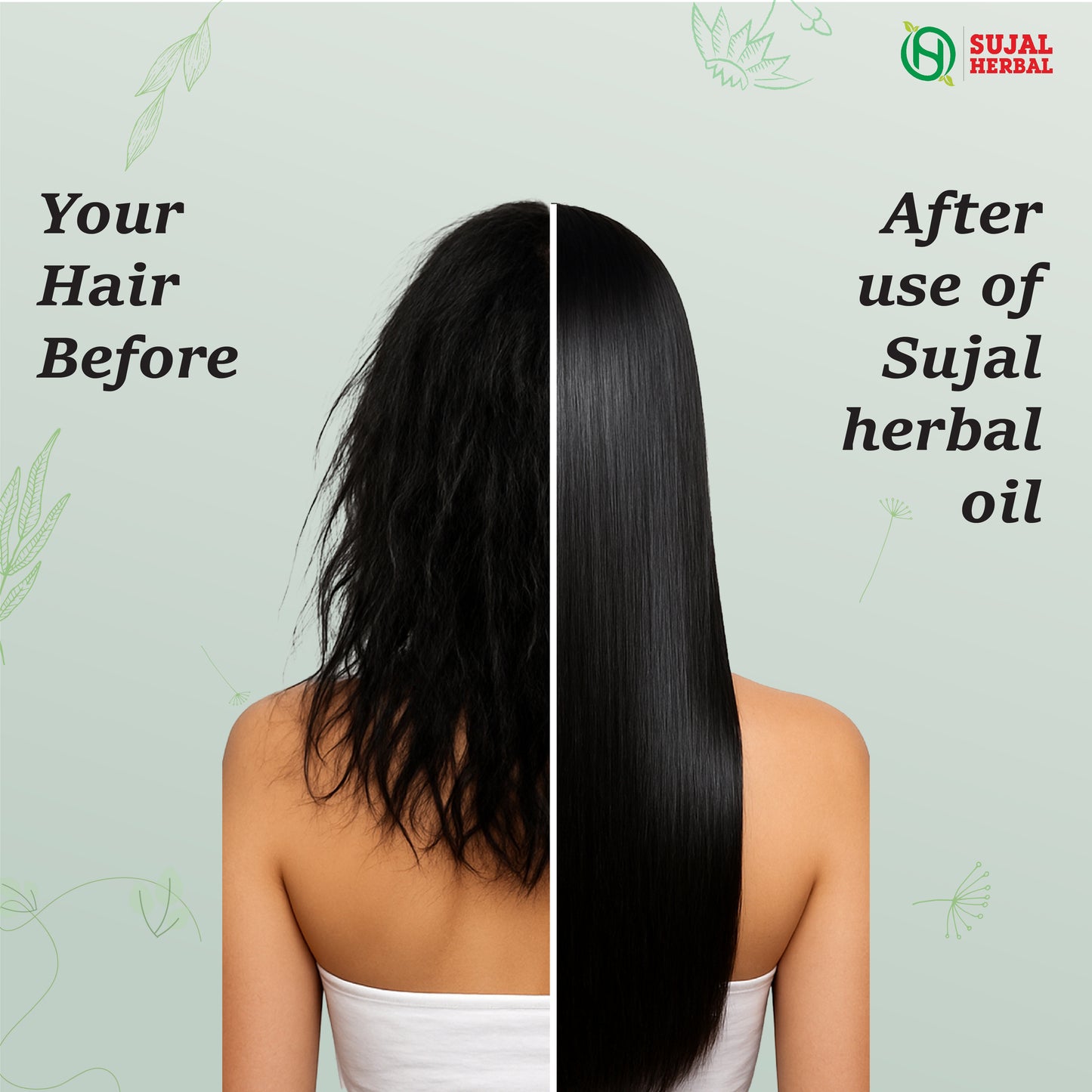 Sujal Herbal Bhringraj & Amla Hair Care Combo – Shampoo & Hair Oil for Hair Fall Control & Growth