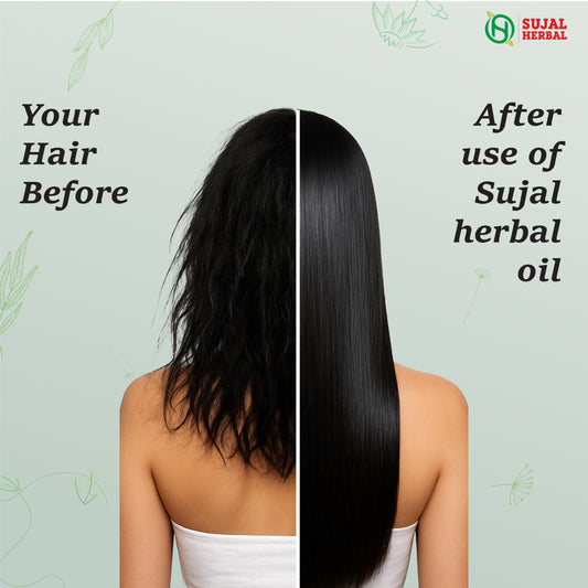 Sujal Herbal Bhringraj & Amla Hair Oil – For Hair Growth, Strong Roots & Natural Shine (100ml)