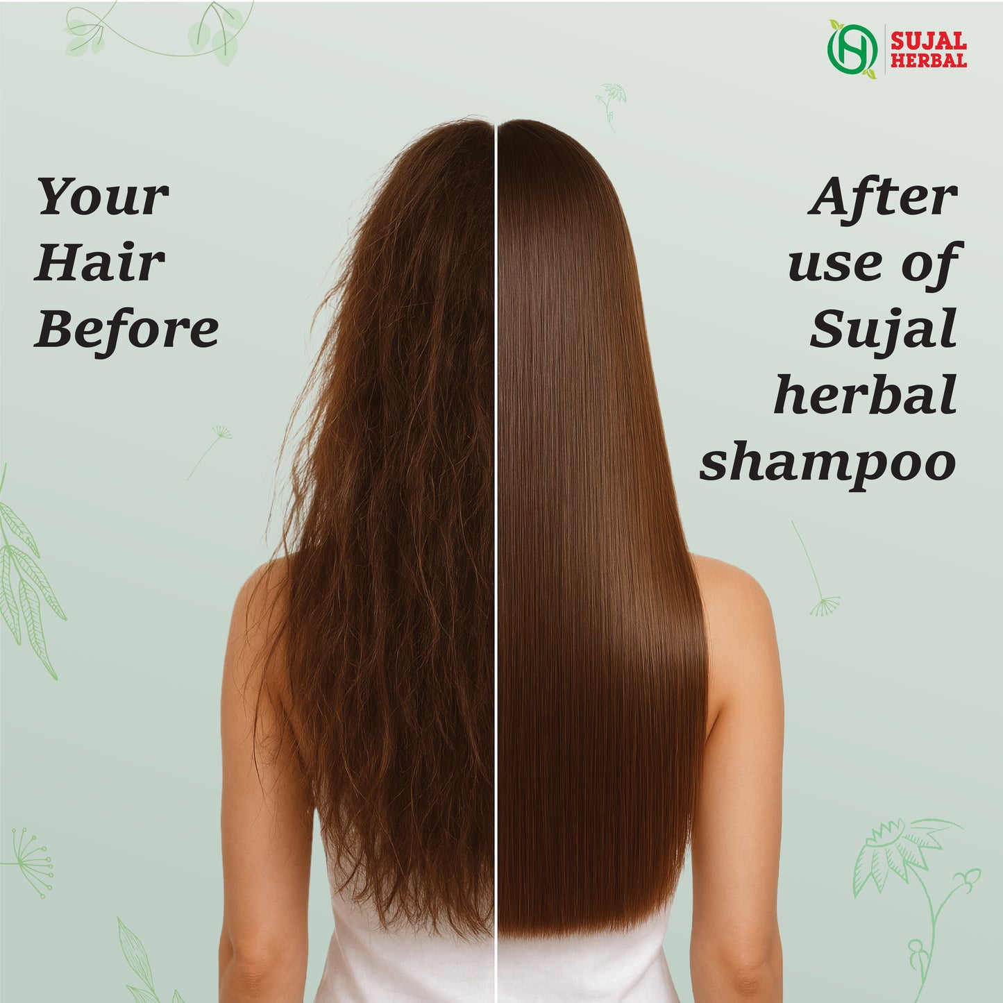Sujal Herbal Bhringraj & Amla Hair Care Combo – Shampoo & Hair Oil for Hair Fall Control & Growth