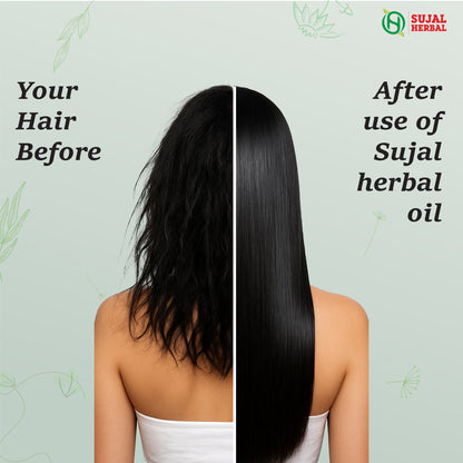 Sujal Herbal Bhringraj & Amla Hair Care Combo – Shampoo & Hair Oil for Hair Fall Control & Growth