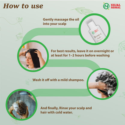 Sujal Herbal Bhringraj & Amla Hair Oil – For Hair Growth, Strong Roots & Natural Shine (100ml)